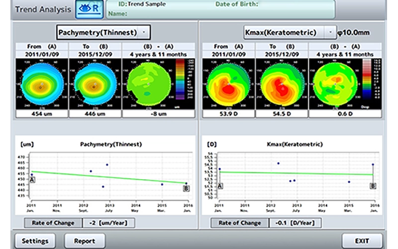 Cornea Trend Analysis